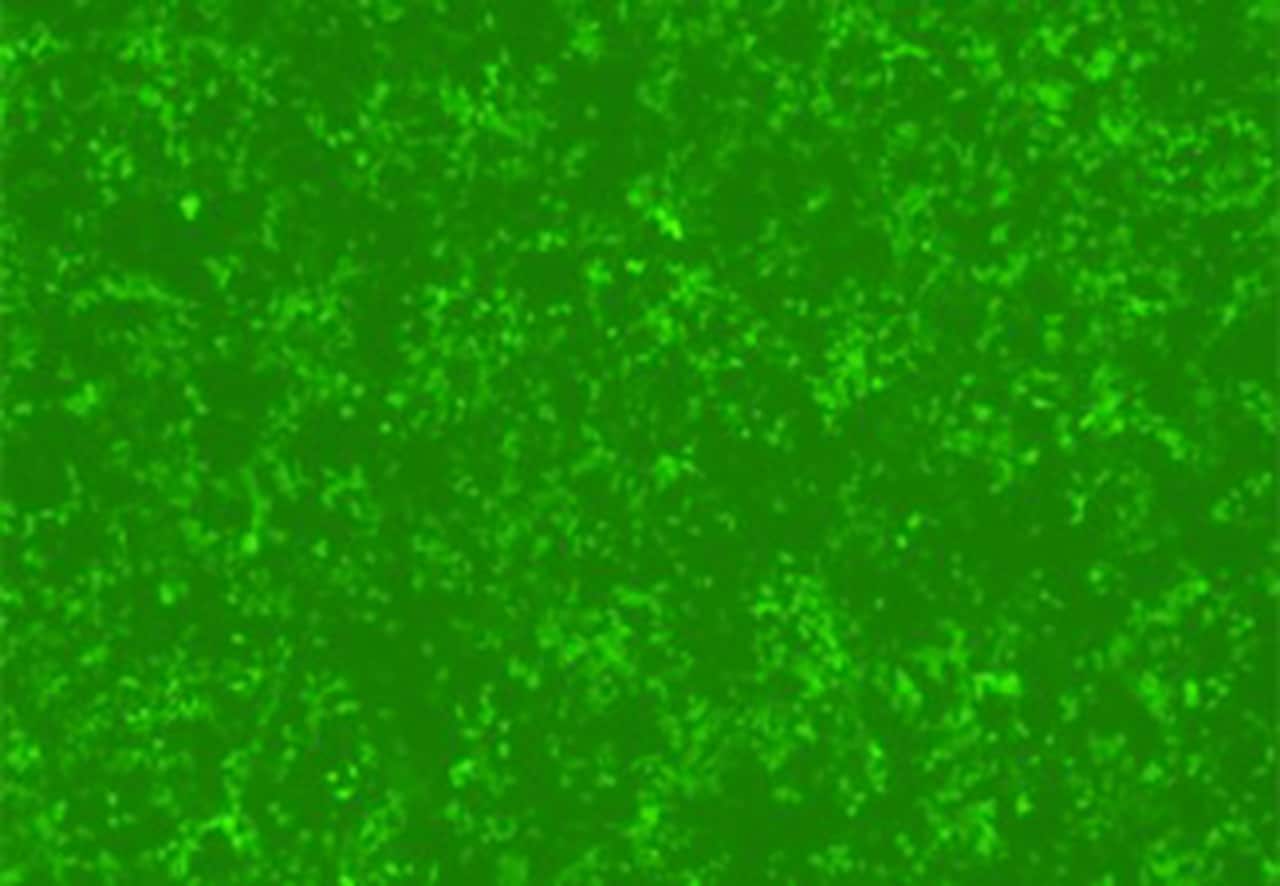 Fluorescent microscopy image of transduced 293T cells by chromatography purified NeonGreen lentiviral vectors.