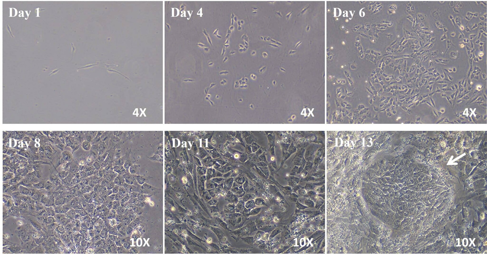 Cell morphology images over 13 days after adding iPSC reprogramming mRNA-LNP.