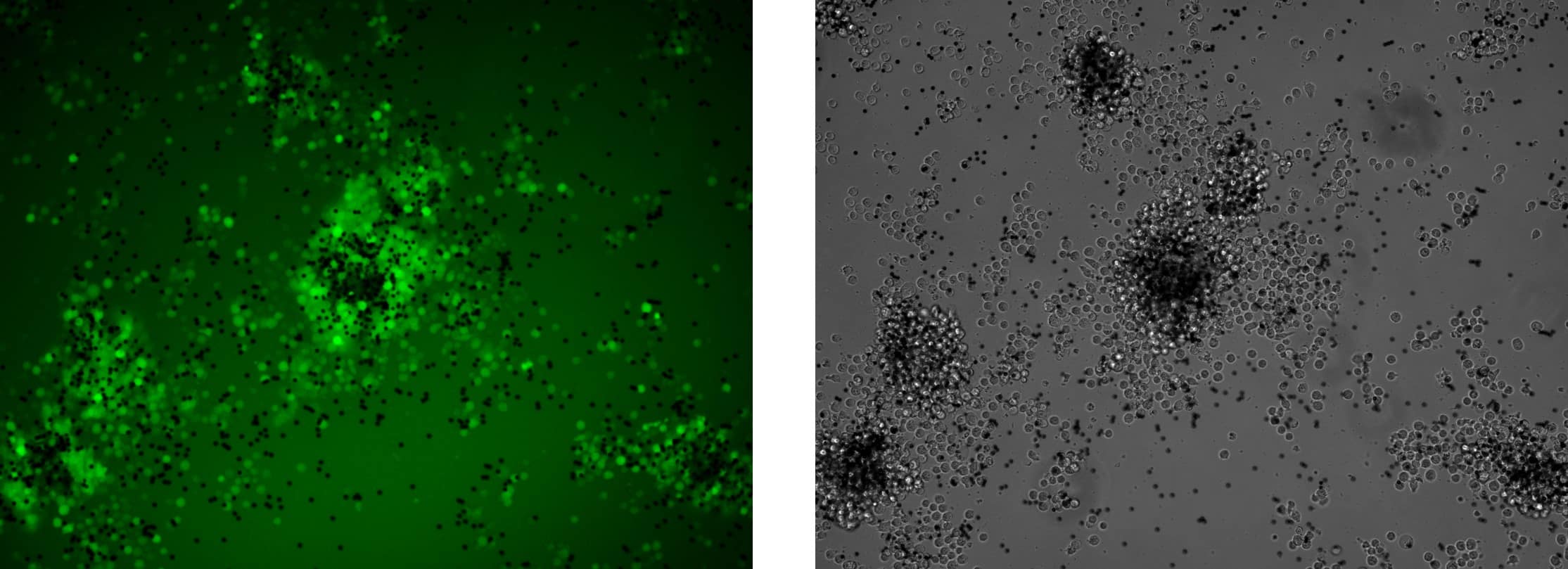 Fluorescent microscopy images show the high green fluorescence indicating high gene expression in Human primary T-cells.