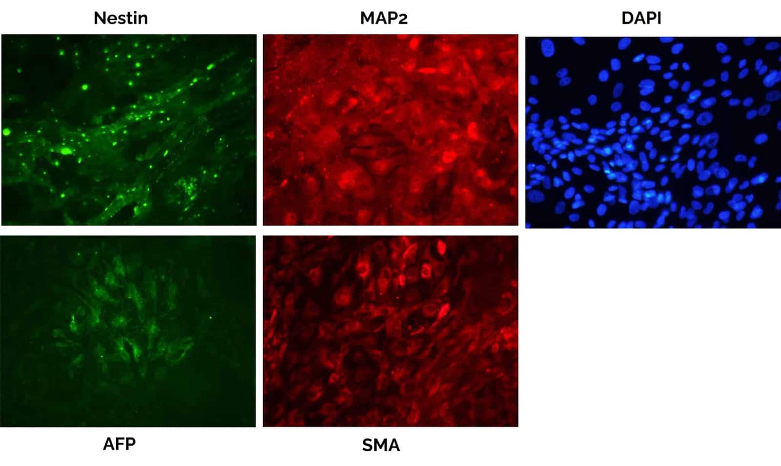 Fluorescent microscopy images of differentiated iPSCs using uBriGene's iPSC reprogramming mRNA-LNP cocktail, showing immunostained Nestin, MAP2, AFP, and SMA.